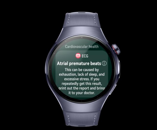 Como um smartwatch pode melhorar seu estilo de vida?